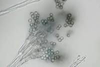 Penicillium - Conidiophore et conidiospores x250